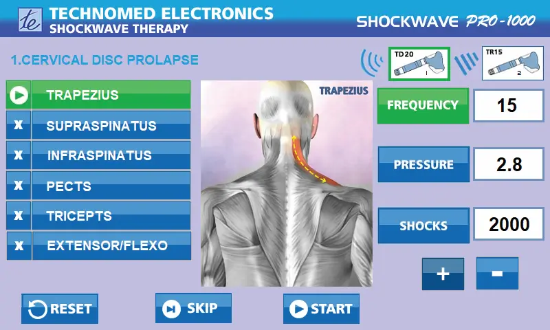 Cervical Disc Prolapse