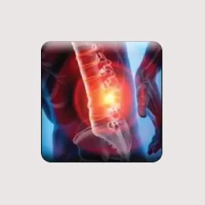 Lumbar Mode