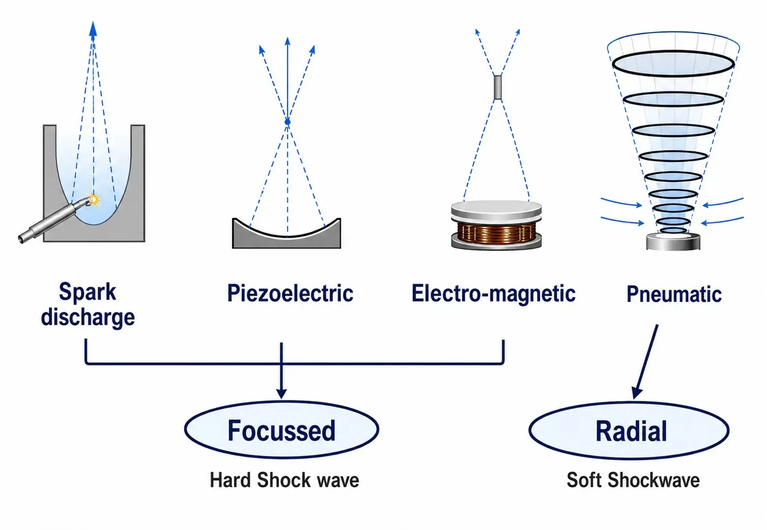 Pneumatic Radial Shockwave Therapy